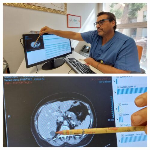 Quando la scienza incontra l'umanità: l'Istituto Tumori di Bari polo d'eccellenza nel segno della grande medicina